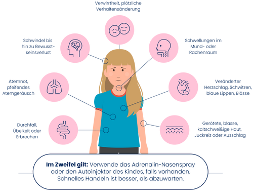 Symptome einer schweren Allergie (Anaphylaxie)