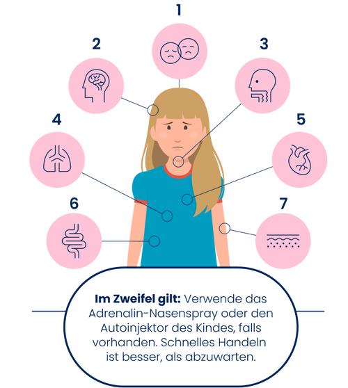 Symptome einer schweren Allergie (Anaphylaxie)